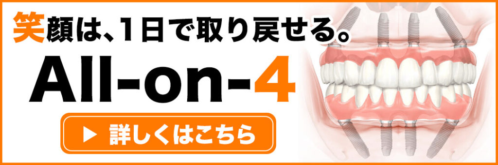 Case02 30代男性上下顎オールオン4インプラント